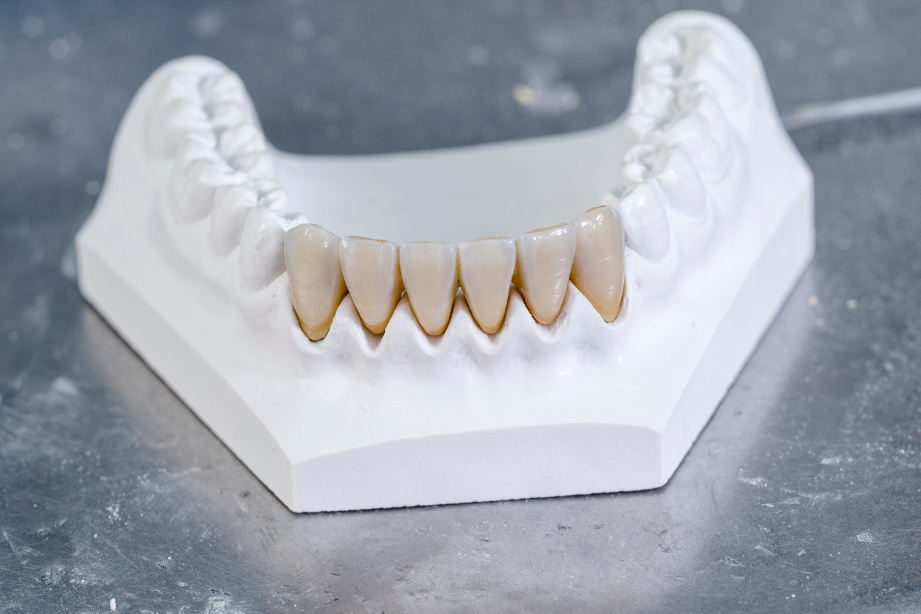 Couronne Full Zircone prix, avantages, et durabilité — free download